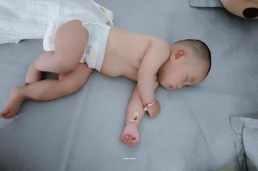 陇南六个月宝宝眼睛散光